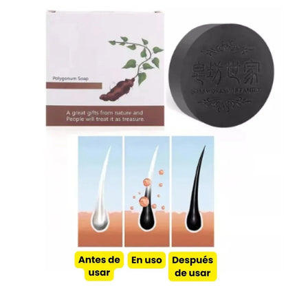 HairRegen® Revitaliza, Promueve el Crecimiento del cabello y Previene la caída