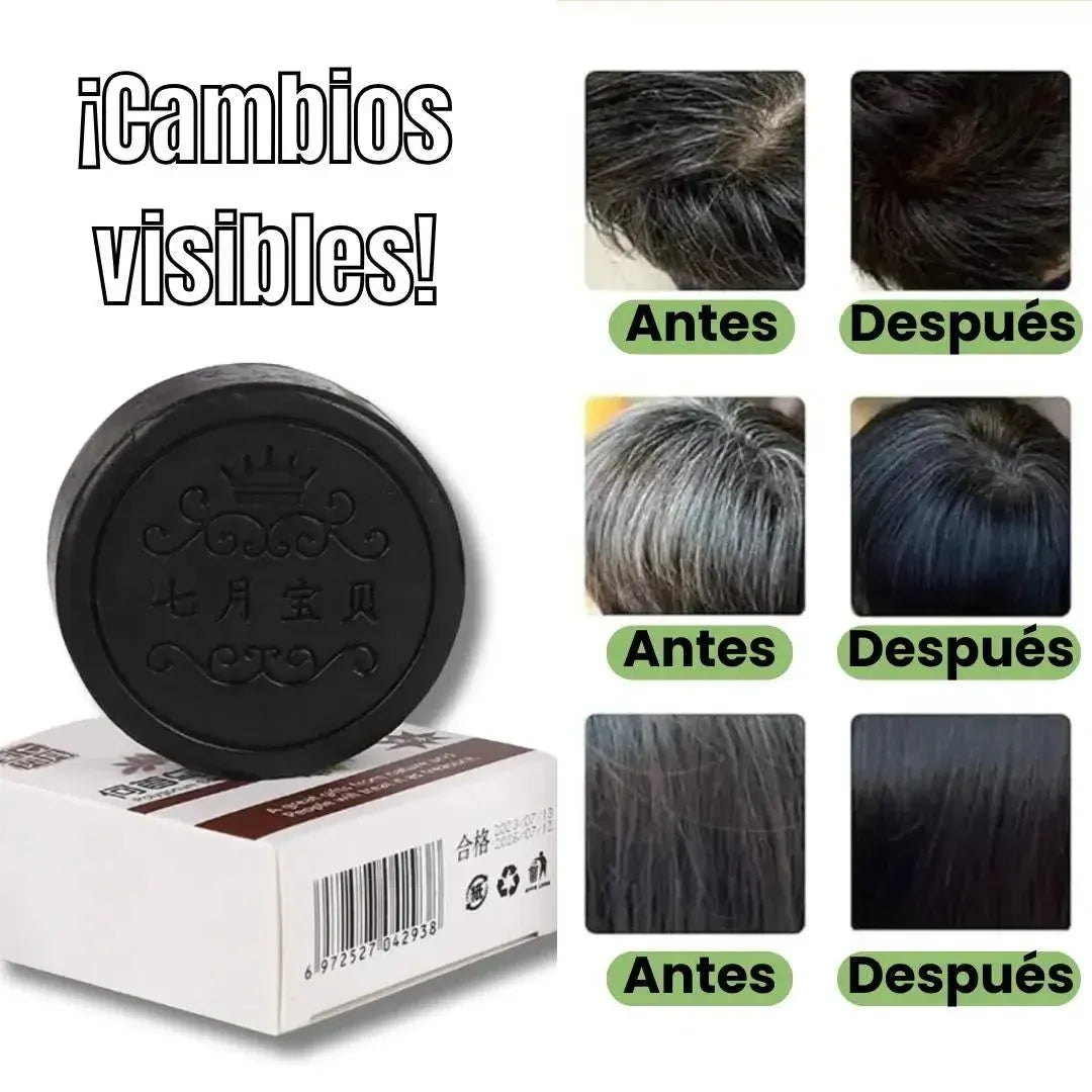 HairRegen® Revitaliza, Promueve el Crecimiento del cabello y Previene la caída