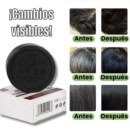 HairRegen® Revitaliza, Promueve el Crecimiento del cabello y Previene la caída